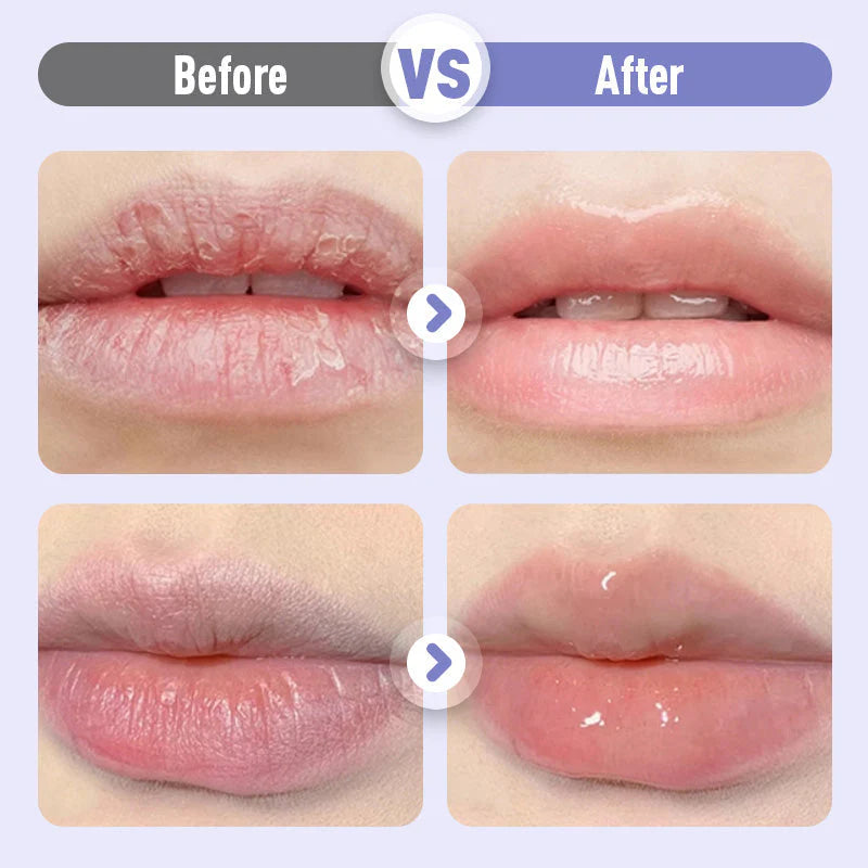 Compre 1 e ganhe 1 grátis⏰Sérum hidratante para lábios com efeito volumizador e antirrugas💧💋